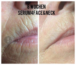 Serum4 Face&Neck