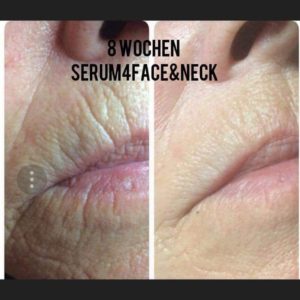 Serum 4 Facer&Neck